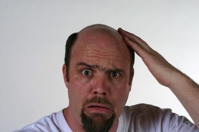 hair loss2