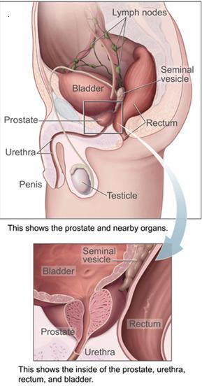 prostate problem1